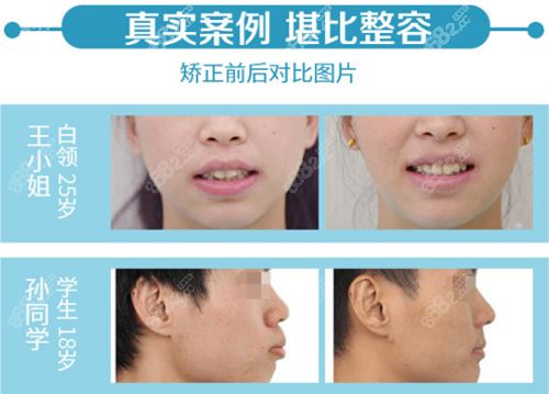 长春2021排名前十口腔医院名单及牙科美容价目表一览